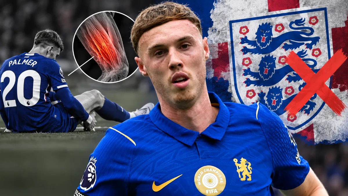 Cole Palmer to miss England matches due to injury